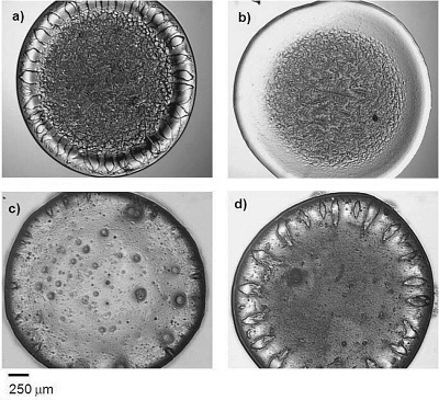 Dried drops of human synovial fluid for osteoarthritis assessment by Raman spectroscopy